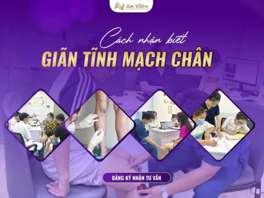 giãn tĩnh mạch khoeo chân