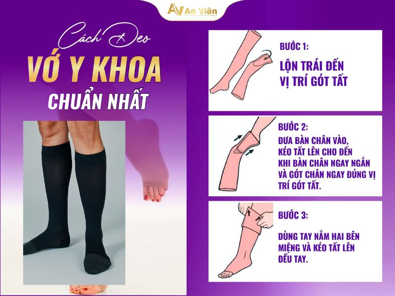 mang vớ giãn tĩnh mạch bao lâu
