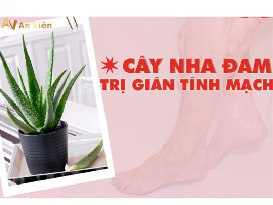 nha đam trị giãn tĩnh mạch