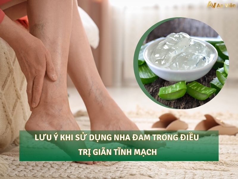 nha đam trị giãn tĩnh mạch