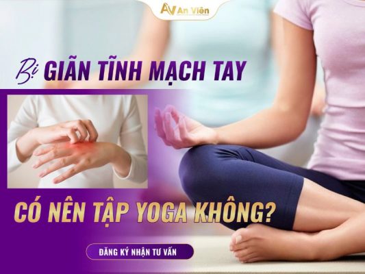 suy giãn tĩnh mạch có nên tập yoga không