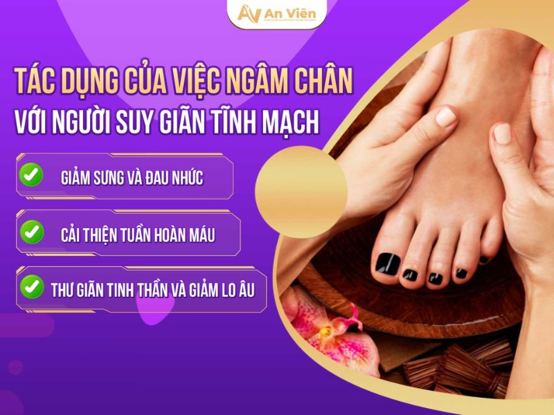 suy giãn tĩnh mạch có ngâm chân được không