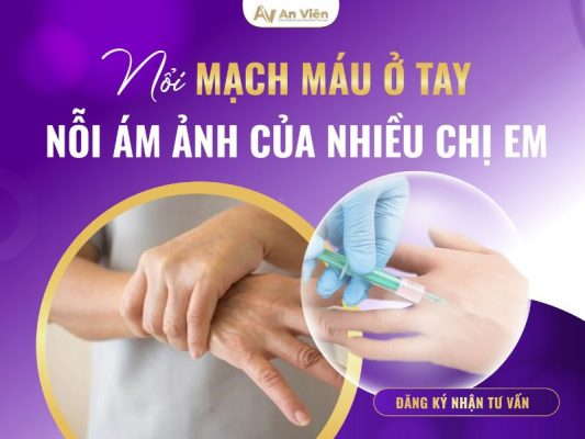 suy tĩnh mạch tay