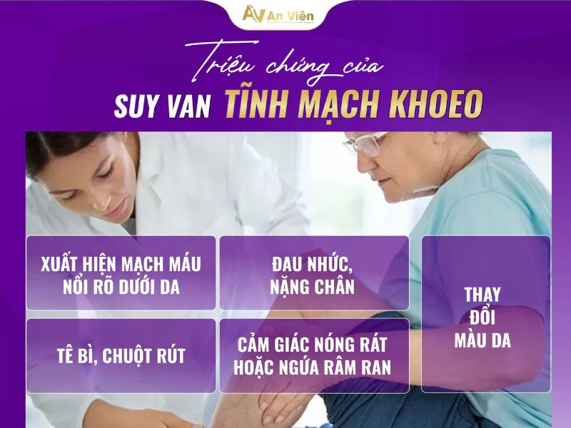 suy van tĩnh mạch khoeo