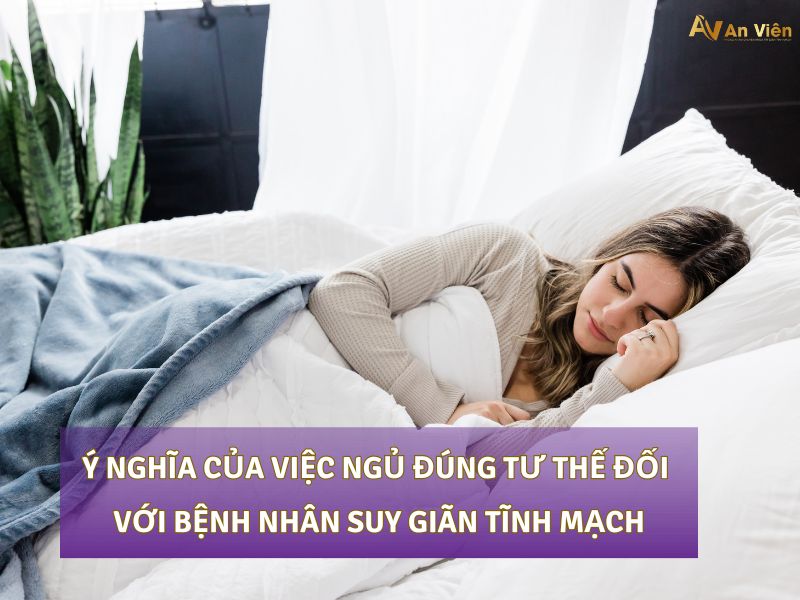 tư thế ngủ cho người suy giãn tĩnh mạch
