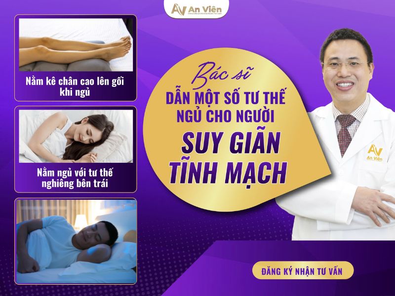tư thế ngủ cho người suy giãn tĩnh mạch