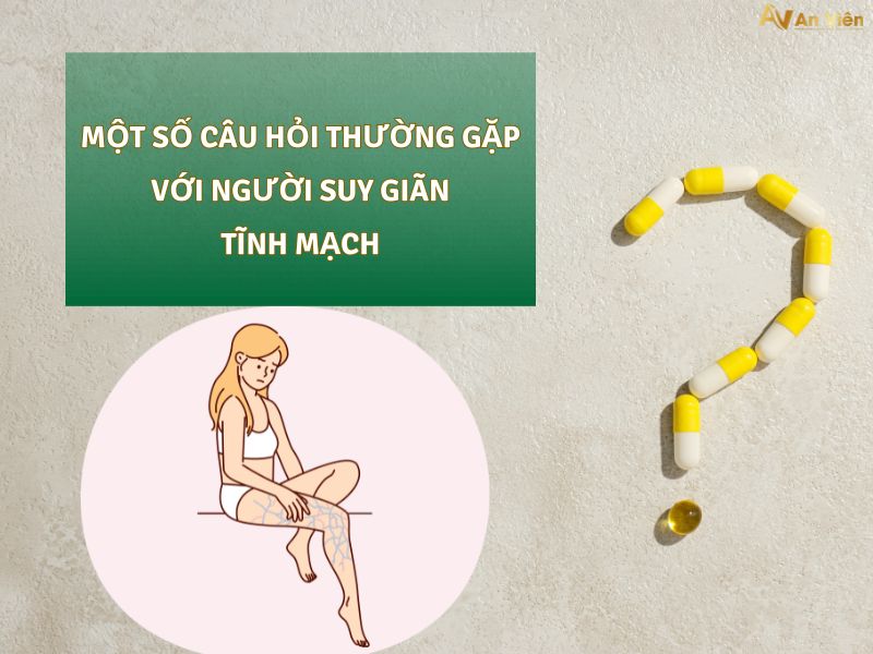 tư thế ngủ cho người suy giãn tĩnh mạch