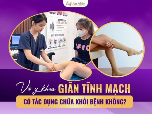 vớ suy giãn tĩnh mạch