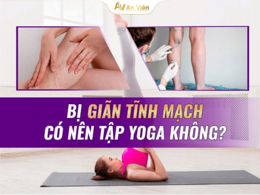 các bài tập suy giãn tĩnh mạch chân