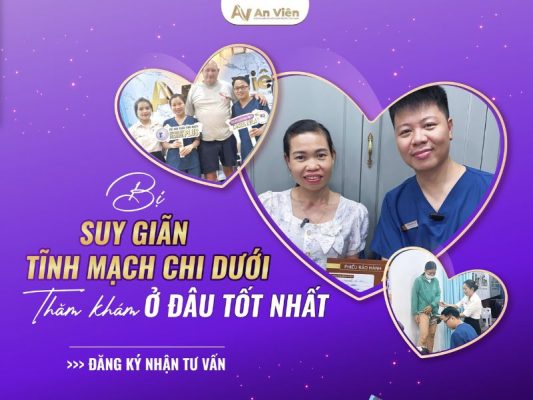 chi phí điều trị giãn tĩnh mạch bằng laser