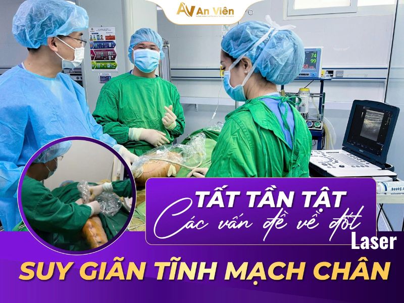 đốt laser suy tĩnh mạch chân