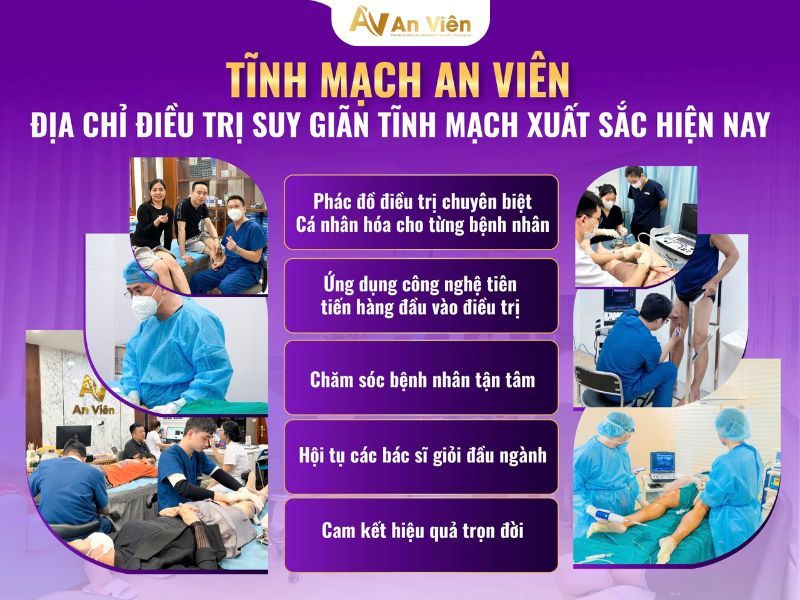 giãn tĩnh mạch có nên đi bộ không