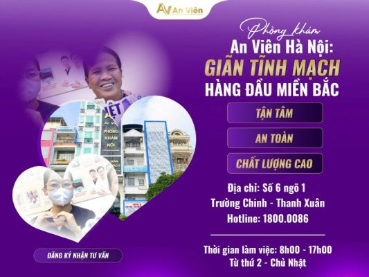 giãn tĩnh mạch mạng nhện