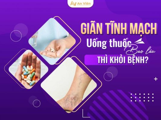 giãn tĩnh mạch mạng nhện