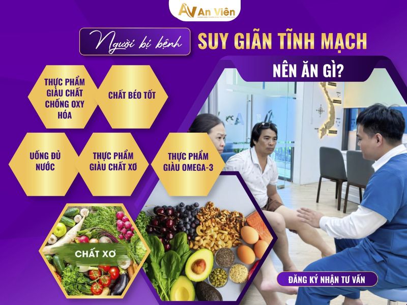 giãn tĩnh mạch nhẹ