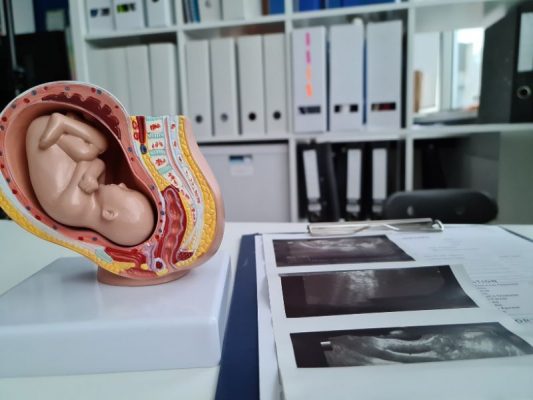 giãn tĩnh mạch rốn thai nhi