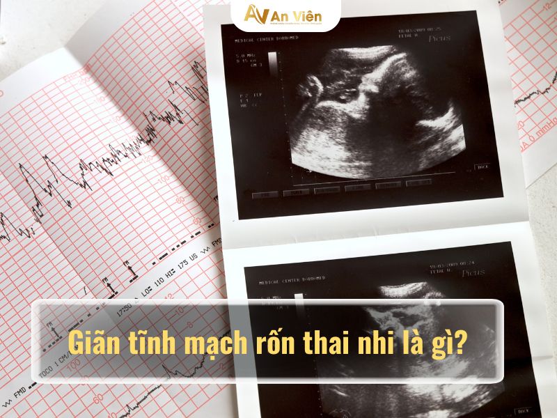 giãn tĩnh mạch rốn thai nhi có nguy hiểm không