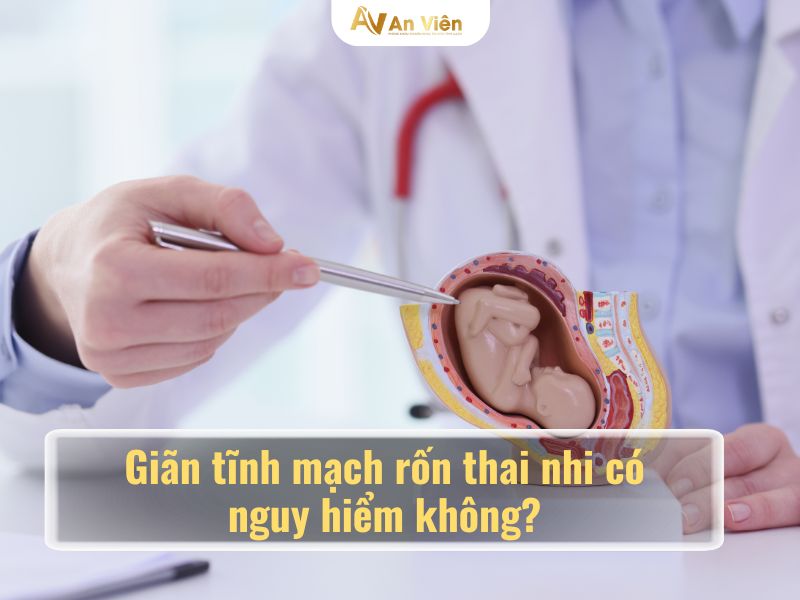 giãn tĩnh mạch rốn thai nhi có nguy hiểm không