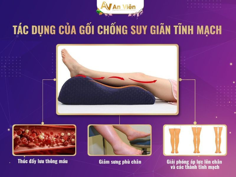 gối gác chân suy giãn tĩnh mạch