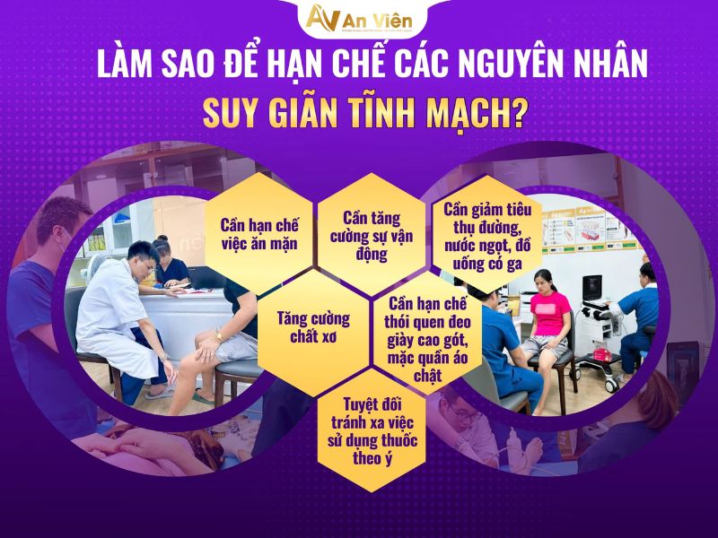 kem bôi giãn tĩnh mạch loại nào tốt nhất