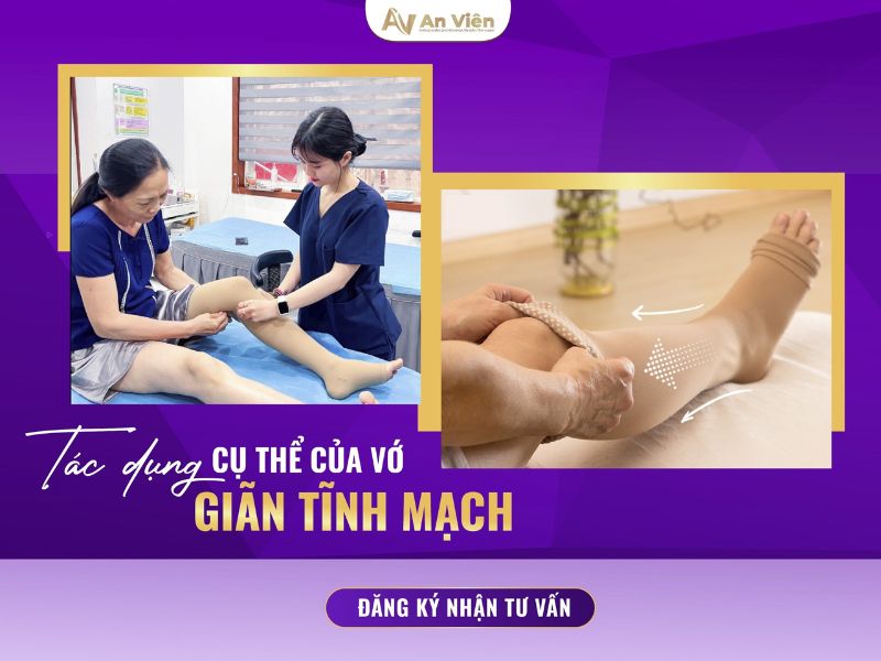 mua vớ giãn tĩnh mạch ở đâu tphcm