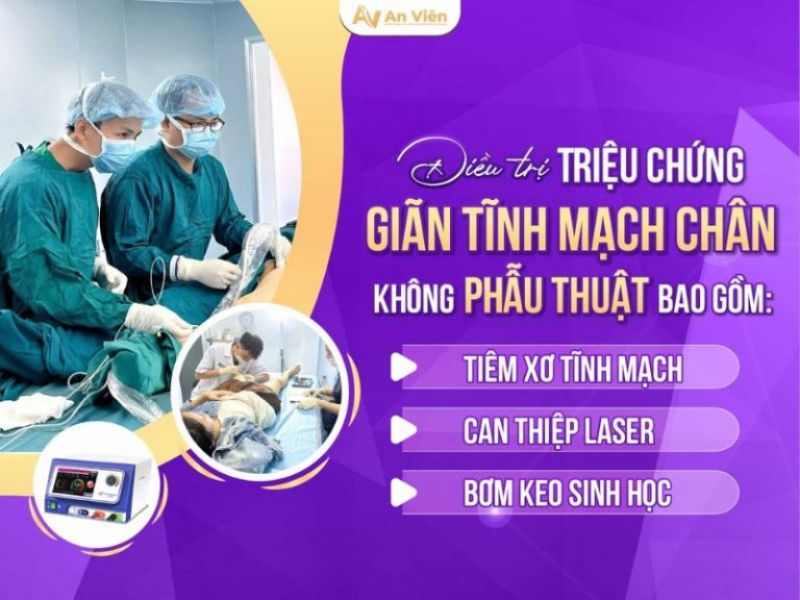 phù chân do suy giãn tĩnh mạch