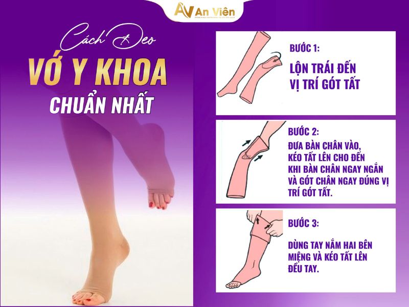 quần giãn tĩnh mạch