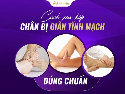 suy giãn tĩnh mạch có nên xoa bóp không