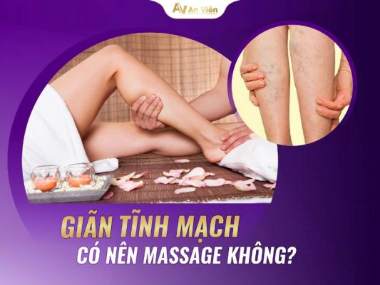 suy giãn tĩnh mạch có nên xoa bóp không