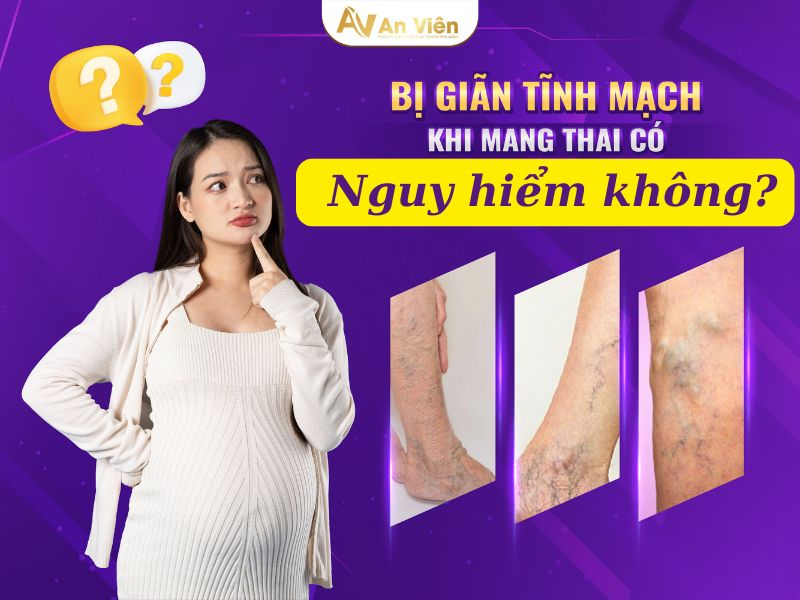 suy giãn tĩnh mạch khi mang thai