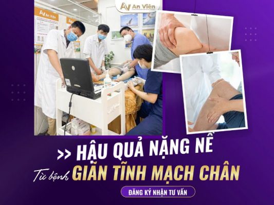 suy van tĩnh mạch sâu chi dưới