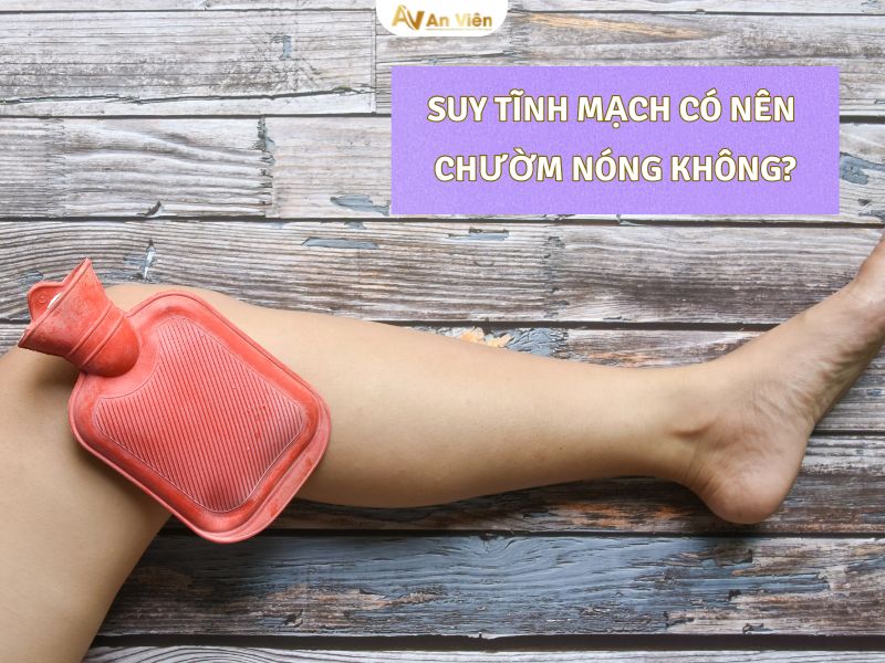 triệu chứng suy giãn tĩnh mạch