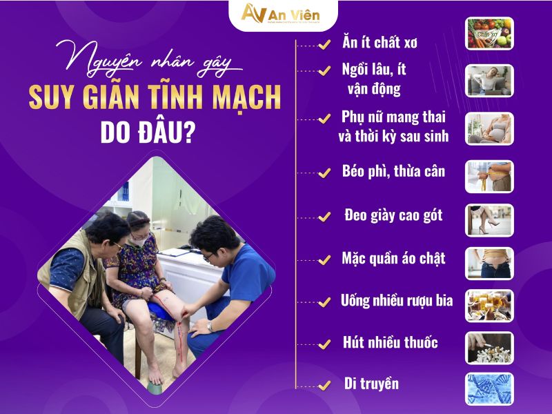 điều trị suy giãn tĩnh mạch nông chi dưới