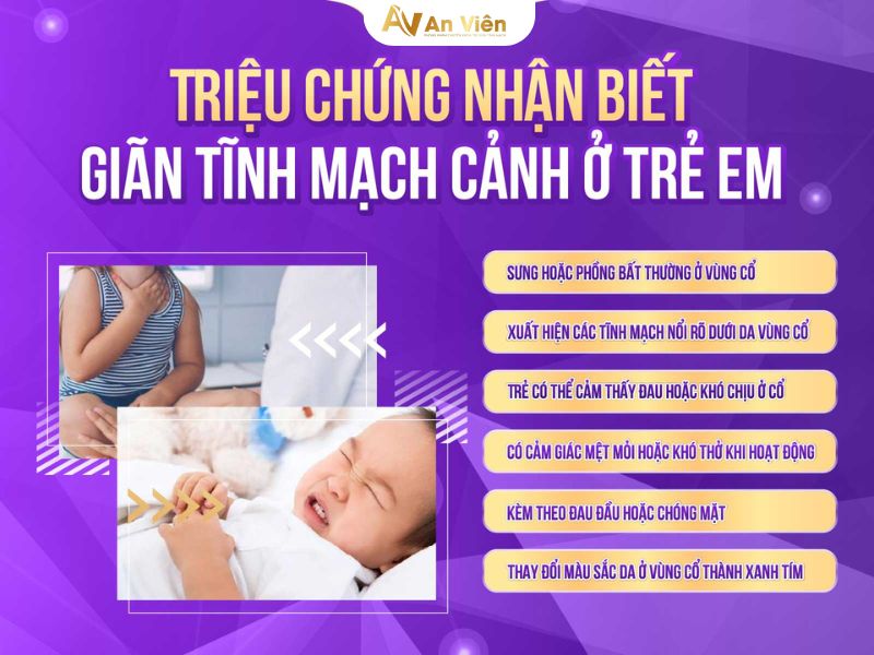 giãn tĩnh mạch cảnh ở trẻ em