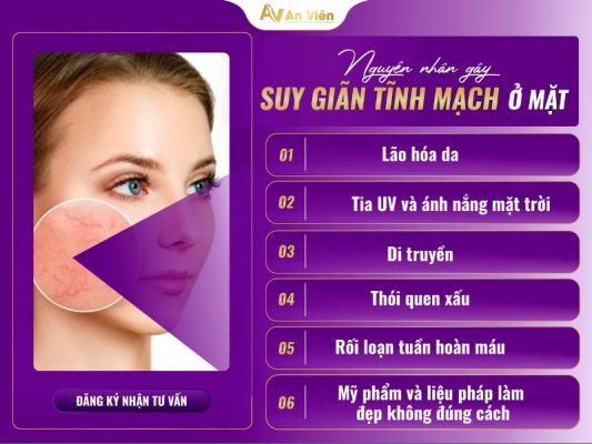 giãn tĩnh mạch ở mặt