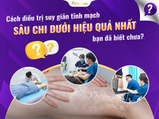 giãn tĩnh mạch ở trẻ em