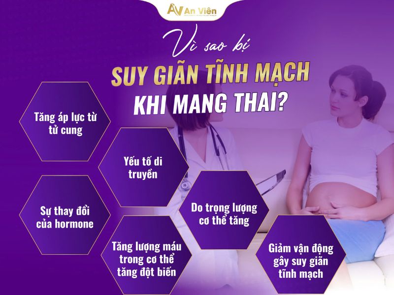 giãn tĩnh mạch sau sinh