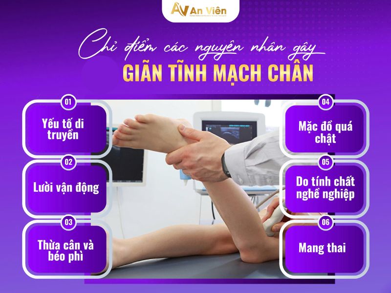 giãn tĩnh mạch mắt cá chân