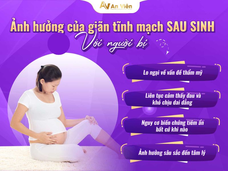 giãn tĩnh mạch mắt cá chân