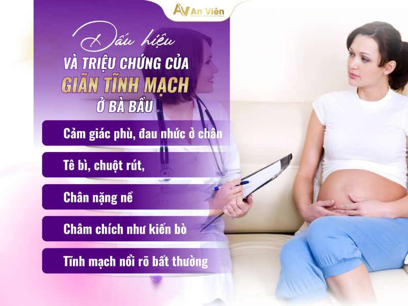 giãn tĩnh mạch sau sinh