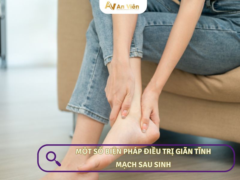 giãn tĩnh mạch sau sinh
