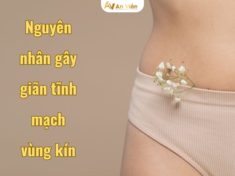giãn tĩnh mạch vùng kín