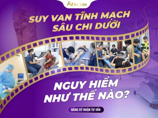 phẫu thuật suy giãn tĩnh mạch