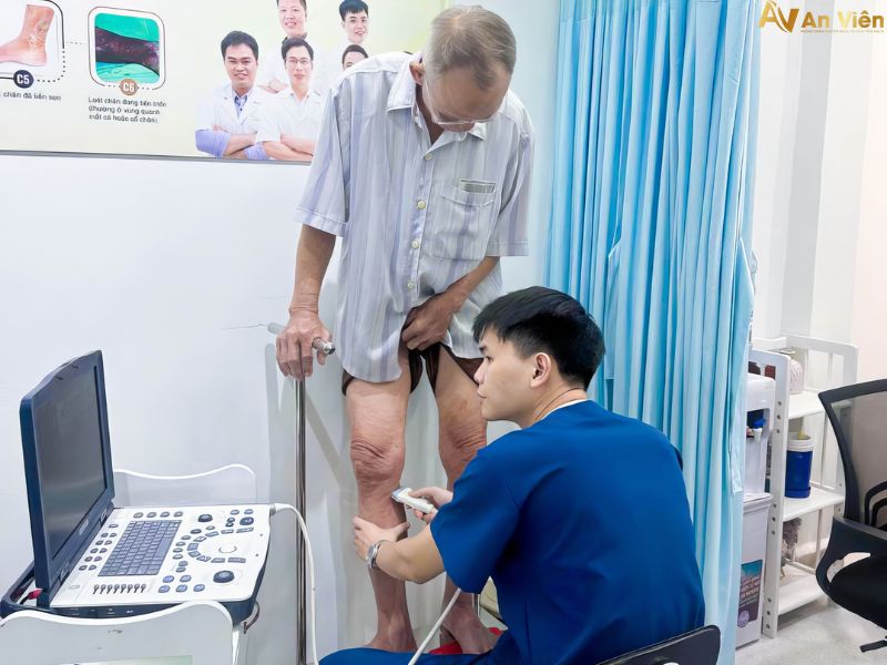 siêu âm giãn tĩnh mạch chi dưới