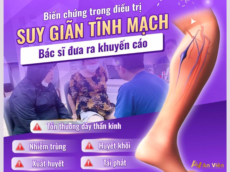 suy giãn tĩnh mạch chân có nguy hiểm không