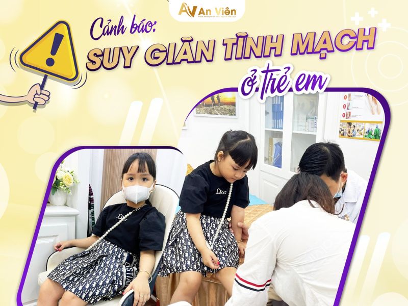suy giãn tĩnh mạch chân ở trẻ em