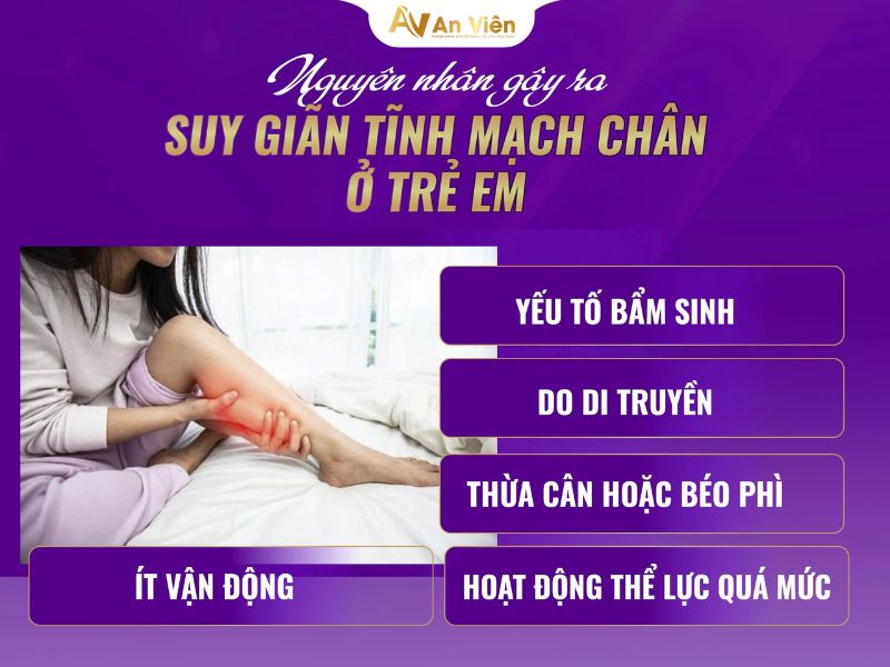 suy giãn tĩnh mạch chân ở trẻ em