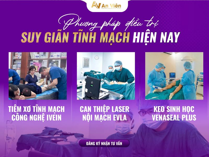 tĩnh mạch an viên
