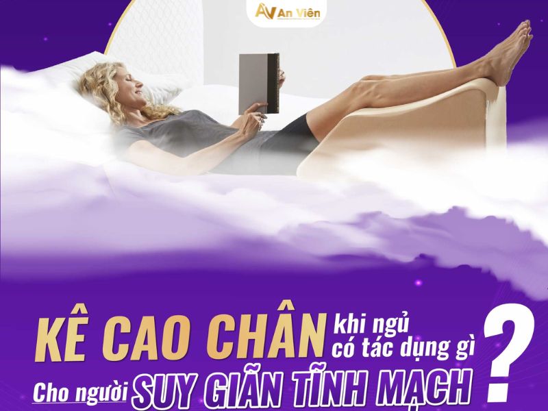 vật lý trị liệu suy giãn tĩnh mạch chân