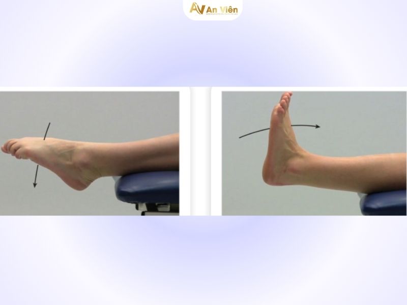 vật lý trị liệu suy giãn tĩnh mạch chân